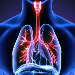 Enfisema