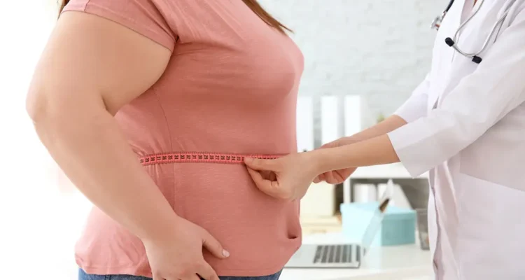 Obesitas, Masalah Kesehatan yang Semakin Dekat dengan Kehidupan Modern