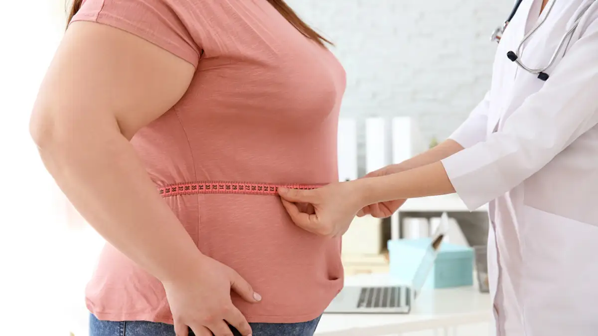 Obesitas, Masalah Kesehatan yang Semakin Dekat dengan Kehidupan Modern